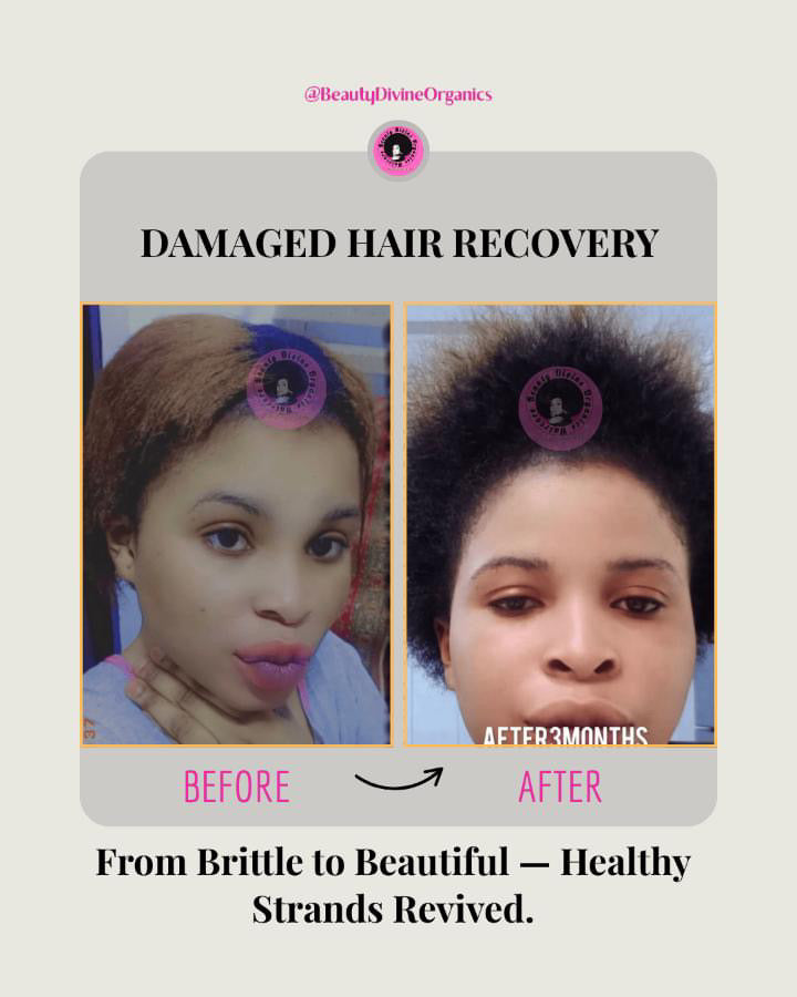 Anti Baldness & Rapid Hair Growth Tonic