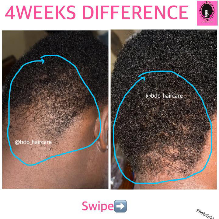 Bald & Edges Repair Oil